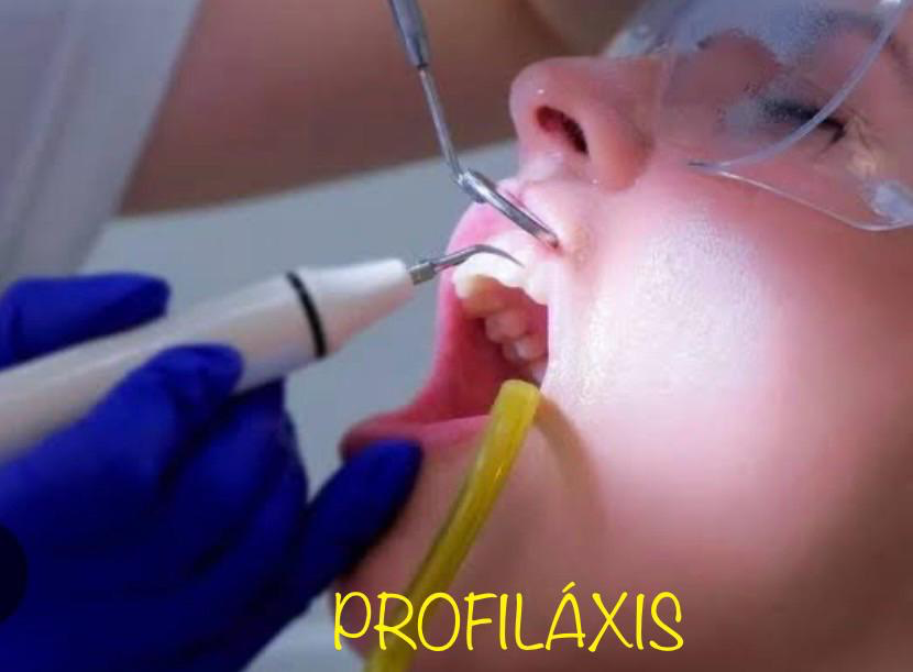 Servicio de profilaxis